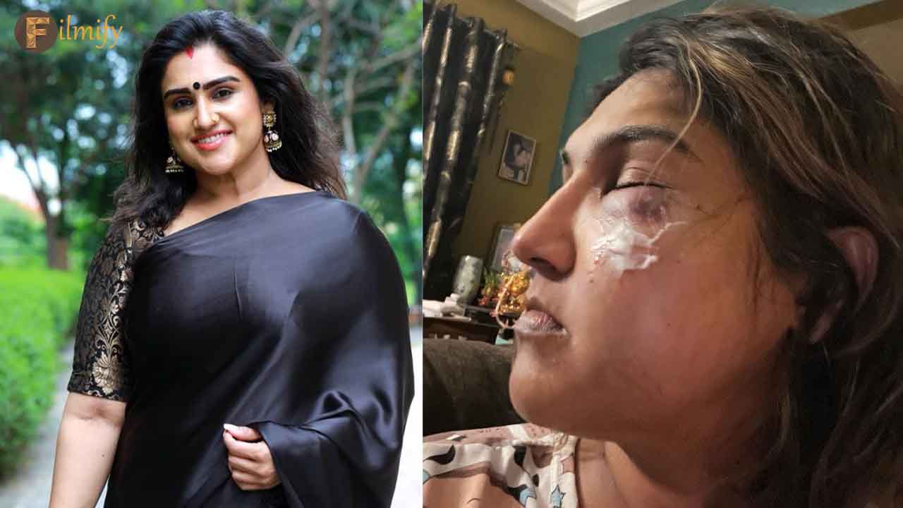 A mysterious person attacked Kollywood Actress Vanitha Vijayakumar